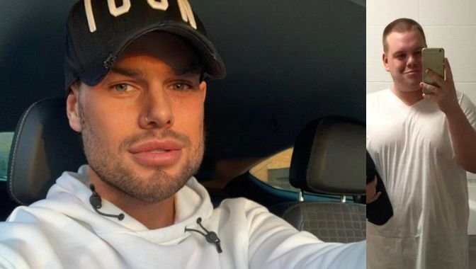 Instagram filter look surgery